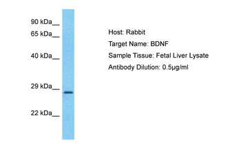 BDNF Rabbit Polyclonal Antibody