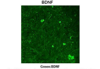 BDNF Rabbit Polyclonal Antibody