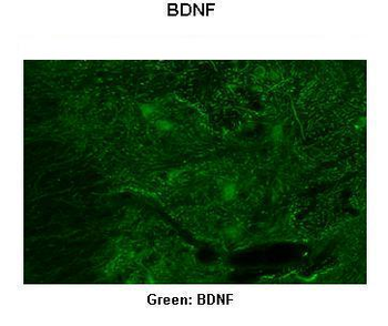 BDNF Rabbit Polyclonal Antibody