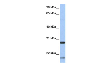 BDNF Rabbit Polyclonal Antibody