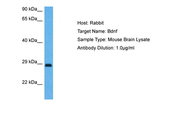 BDNF Rabbit Polyclonal Antibody