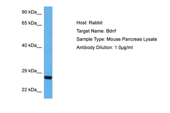 BDNF Rabbit Polyclonal Antibody