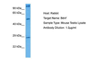 BDNF Rabbit Polyclonal Antibody