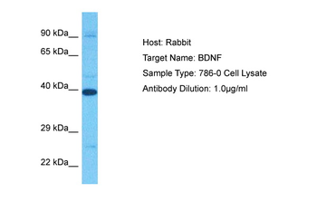 BDNF Rabbit Polyclonal Antibody