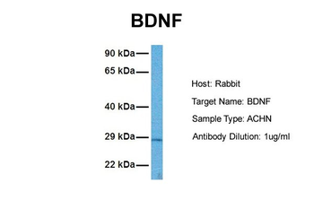 BDNF antibody