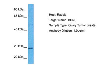 BDNF Rabbit Polyclonal Antibody