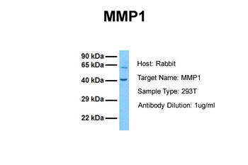 MMP1 antibody