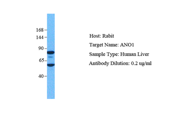 TMEM16A antibody