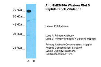 TMEM16A antibody