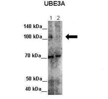 UBE3A antibody