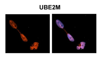 UBE2M antibody