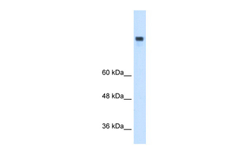 MTTP antibody