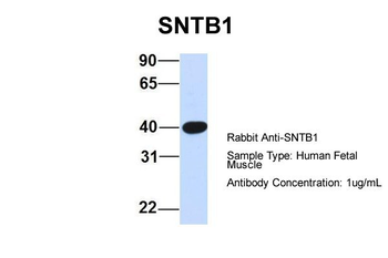 SNTB1 antibody