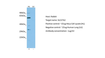 SLC27A2 antibody