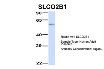 SLCO2B1 antibody