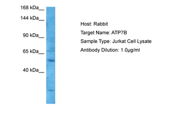 ATP7A antibody