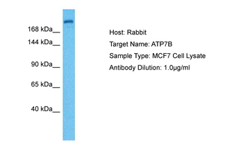 ATP7A antibody