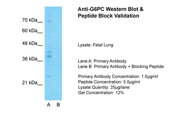 G6PC antibody