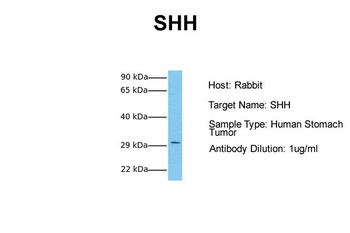 SHH antibody