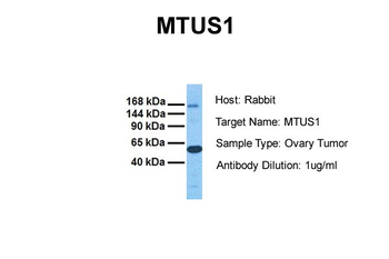 MTUS1 antibody