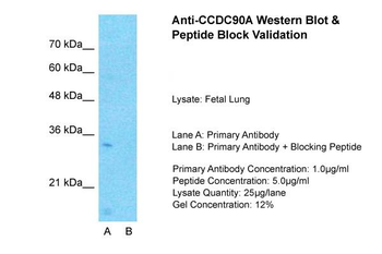 CCDC90A antibody