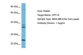 CPT1A antibody