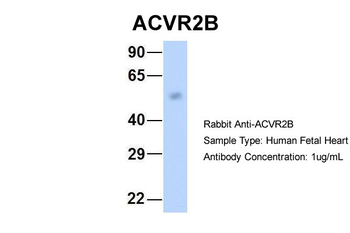ACVR2B antibody