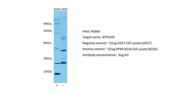 ATP6V0C antibody