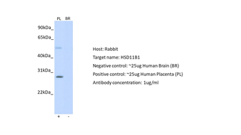 HSD11B1 antibody