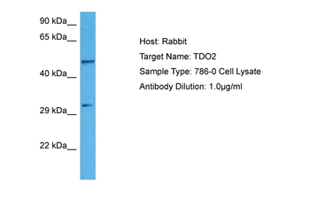 TDO2 antibody