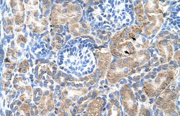 SGPP2 antibody