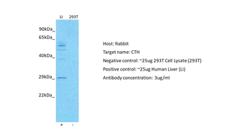 CTH antibody
