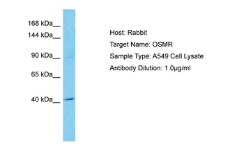 OSMR antibody