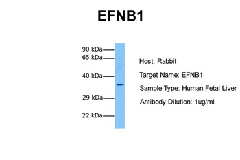 EFNB1 antibody