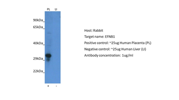 EFNB1 antibody