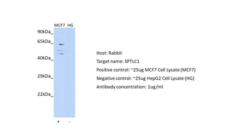 SPTLC1 antibody