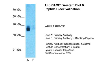 BACE1 antibody
