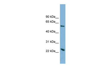 TMEM161A antibody