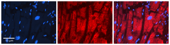 PDHB antibody