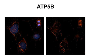 ATP5F1B antibody