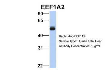 EEF1A2 antibody