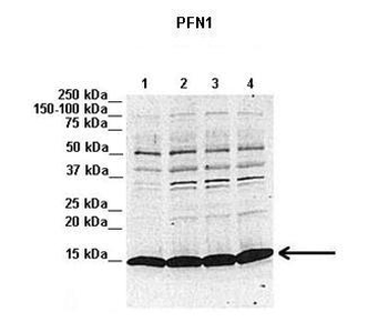 PFN1 antibody