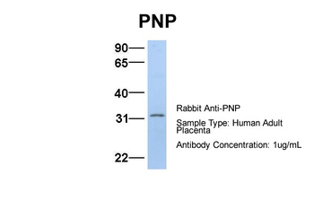 NP antibody