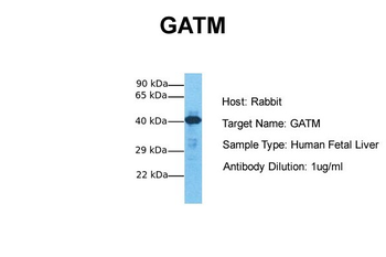 GATM antibody