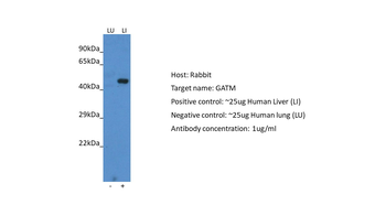 GATM antibody