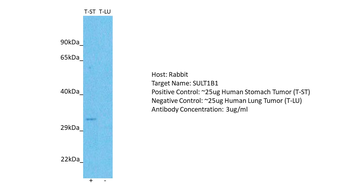 SULT1B1 antibody