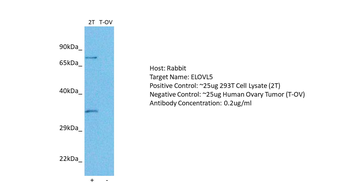 ELOVL5 antibody