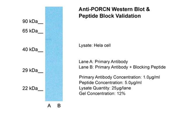 PORCN antibody