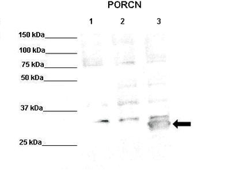Porcn antibody