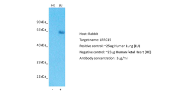 LRRC15 antibody